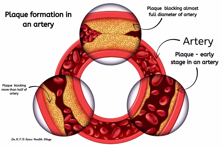 Understanding The Uses Of CT-Angiography In...