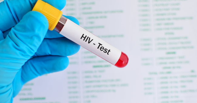 Testing for HIV — The First...